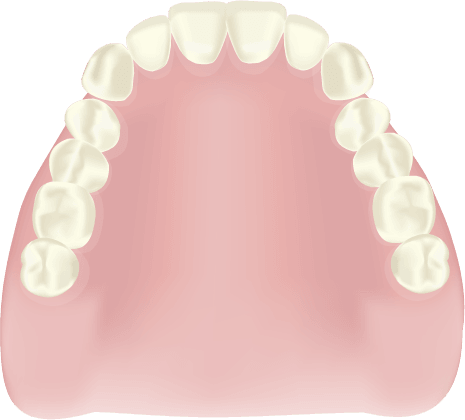 熱可塑性樹脂義歯
